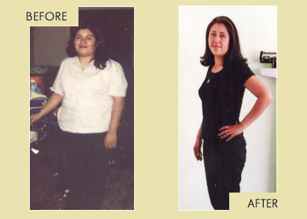 Treatment for Obesity